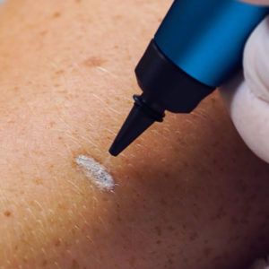 Välkomna till ett laser institut i Malmö