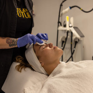 Vi erbjuder laser och Microneedling i Malmö