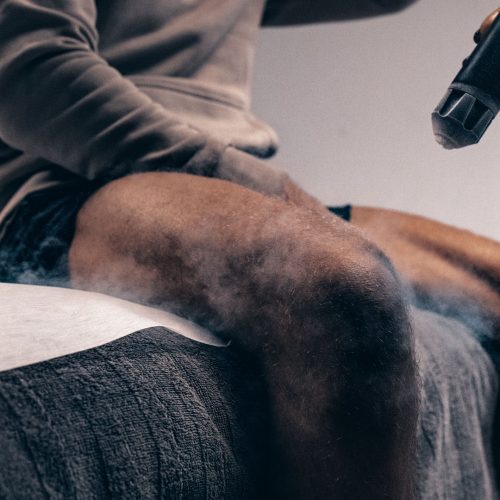 Olika behandlingar hos Zoi Beauty - Cryotherapy i Malmö